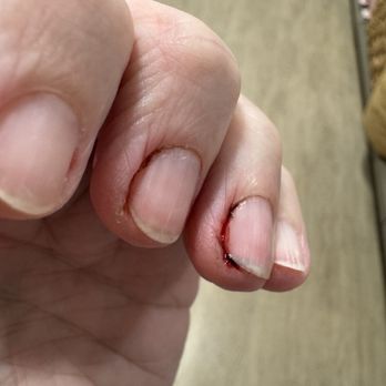 Lee Nails - Bleeding cuticles - Nail Salons Near Me - Valparaiso, Indiana