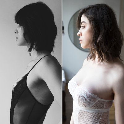Breast Augmentation - Breast Augmentation Before And After