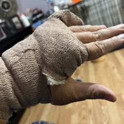 My hand following surgery on the pinky. You can the splint buried under the bandage wrap.