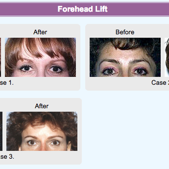 Donn Hickman, MD - Cosmetic Surgeons Near Me - Long Beach, California