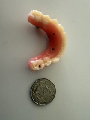 AFFORDABLE DENTURES & IMPLANTS - Updated September 2025