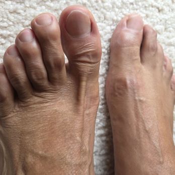 Apple Nails - Deluxe pedicure, calus removal and all. - Nail Salons Near Me - Philadelphia, Mississippi Apple Nails - Deluxe pedicure, calus removal and all. - Nail Salons Near Me - Philadelphia, Mississippi