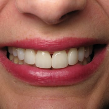StudioNINE30 - Bright and shiny smile - General Dentistry Near Me - Bend, Oregon StudioNINE30 - Bright and shiny smile - General Dentistry Near Me - Bend, Oregon