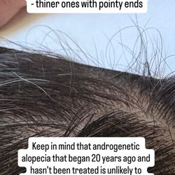 HairVive Trichology Clinic