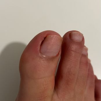 Popular Nails - 1hr after my pedicure, poorly done polish removed. You can see the caked dried blood & my toe all red & irritated from her cutting it. - Nail Salons Near Me - Carlsbad, California Popular Nails - 1hr after my pedicure, poorly done polish removed. You can see the caked dried blood & my toe all red & irritated from her cutting it. - Nail Salons Near Me - Carlsbad, California