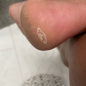 Nail Fever III - an hour after my pedicure. - Nail Salons Near Me - Charleston, South Carolina