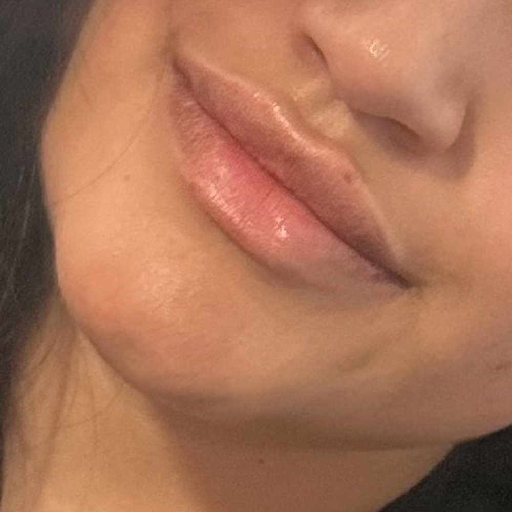 Lazer Lounge - After procedure - Laser Hair Removal Near Me - Studio City, California Lazer Lounge - After procedure - Laser Hair Removal Near Me - Studio City, California