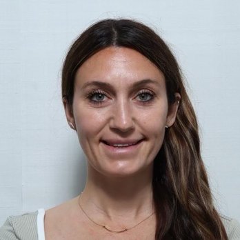 Eos Rejuvenation - Before after - Cosmetic Surgeons Near Me - Beverly Hills, California