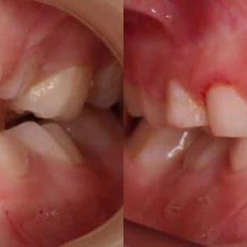 TLC Pediatric Dentistry - Pediatric Dentists Near Me - Cedar Park, Texas TLC Pediatric Dentistry - Pediatric Dentists Near Me - Cedar Park, Texas