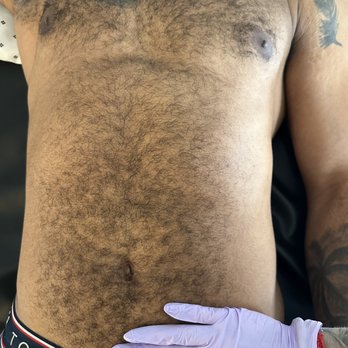 D.beauty - Before photo of men's full chest and stomach wax - Waxing Near Me - Fremont, California D.beauty - Before photo of men's full chest and stomach wax - Waxing Near Me - Fremont, California
