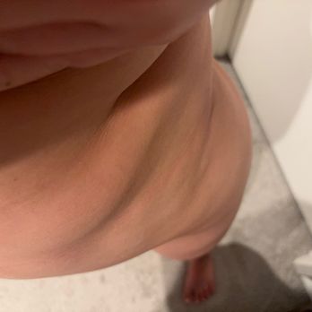 Alluring Plastic Surgery - Lump all over my body where - Cosmetic Surgeons Near Me - Miami, Florida Alluring Plastic Surgery - Lump all over my body where - Cosmetic Surgeons Near Me - Miami, Florida