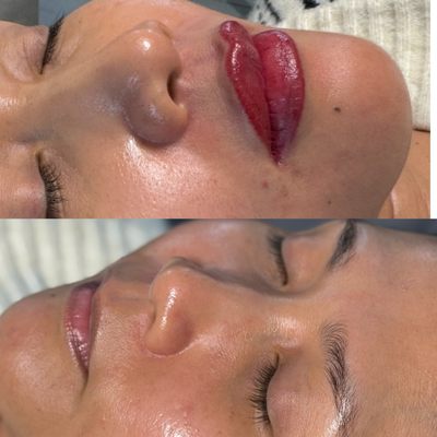 Lip Shading - Lip shading is a modern form of cosmetic tattooing that deposit pigment into the top layer of the skin using a specialized machine. Unlike traditional lipstick or liner, this technique delivers a soft, smudge-resistant flush of color that enhances your lips’ natural tone, improves symmetry, and creates the illusion of fuller lips, without adding volume. Lip Shading - Lip shading is a modern form of cosmetic tattooing that deposit pigment into the top layer of the skin using a specialized machine. Unlike traditional lipstick or liner, this technique delivers a soft, smudge-resistant flush of color that enhances your lips’ natural tone, improves symmetry, and creates the illusion of fuller lips, without adding volume.