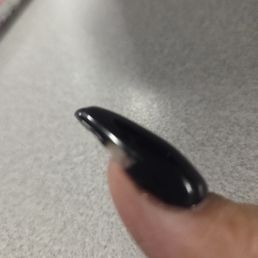 Chip thumb and thick foil nail Chip thumb and thick foil nail