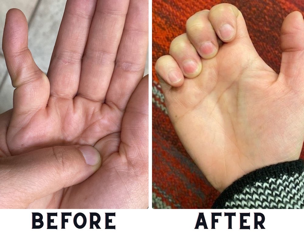 WASHINGTON HAND THERAPY KIRKLAND Updated October 2024 10 Reviews