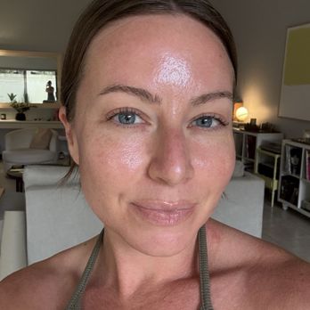 VIO Med Spa - Delray Beach - No makeup!!!! All thanks to Caitlin. My skin used to be red and textured. - Medical Spas Near Me - Delray Beach, Florida