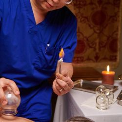 Acupuncture Cupping