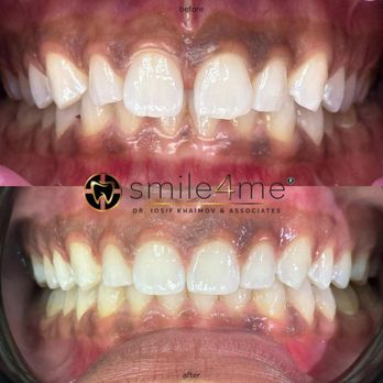 smile4me Dental Care - Astoria, Queens - Endodontists Near Me - Queens, New York smile4me Dental Care - Astoria, Queens - Endodontists Near Me - Queens, New York
