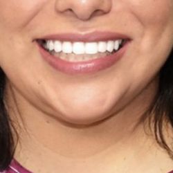 Helotes Cosmetic & Family Dentistry