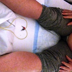 Boulder Family Acupuncture - We Love to use e-stim in labor at BCH!