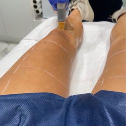 Bellair Laser Clinic
