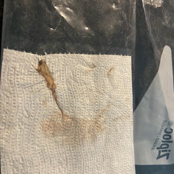 Ronald E Hawk, DDS - This photo shows the dead piece of skin that came from inside of my mouth after a routine procedure with Dr. Hawk. - Cosmetic Dentists Near Me - Boca Raton, Florida