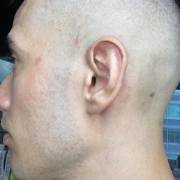 Skin fade with skin cut. At least it stopped bleeding. Skin fade with skin cut. At least it stopped bleeding.