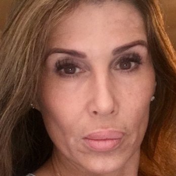 The Nikolov Center for Plastic Surgery: Nicholas Nikolov, M.D - Magnificent results from the laser ! - Cosmetic Surgeons Near Me - Beverly Hills, California