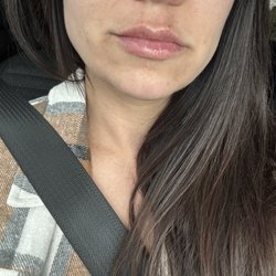 Concierge Medical Aesthetics - After!