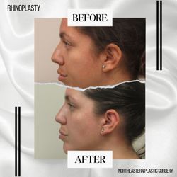 Northeastern Plastic Surgery