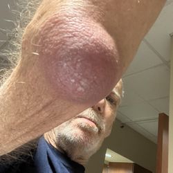 Texas Health Presbyterian Hospital Denton - THIS IS FROM TYHE SLIP AND FALL IN HOSPITALTHAT THE HODSPITAL BILLED MY INSR $3,000 FOR. TYHE NURSE CALLEDSECURITY ON ME SAIDI WAS THREATE