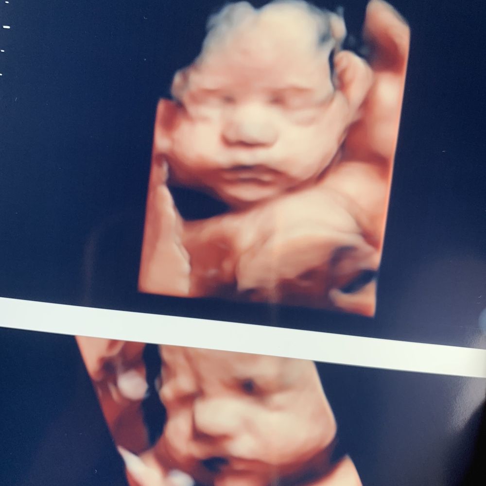 32 weeks