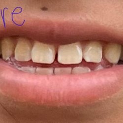 Lynann M Mastaj, DMD - My teeth before
