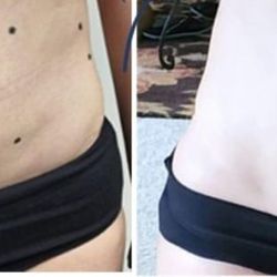 B Fit Body Sculpting