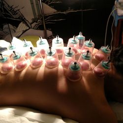 Bao's Healing Center - First time trying cupping. Very relaxing. I was very skeptical