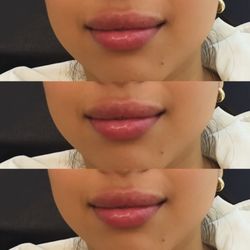 iBella Aesthetics