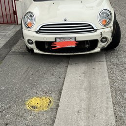 Before (directly after my accident) Before (directly after my accident)