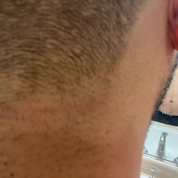 Apple Salon Hair & Nails - cut on the neck - Hair Stylists Near Me - Milpitas, California Apple Salon Hair & Nails - cut on the neck - Hair Stylists Near Me - Milpitas, California