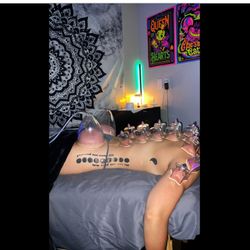 Allie's Hands On Healing - Cupping