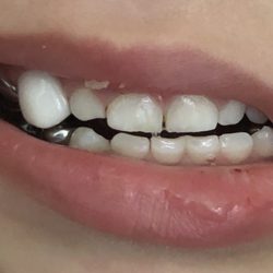 Britestars Pediatric Dentistry - mal trabajo