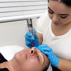 Glass Skin Aesthetics - I was doing a micro-channeling treatment on my beautiful client.