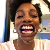 Photo of Smile Direct Club - Washington, DC, United States. The mouth spacers!