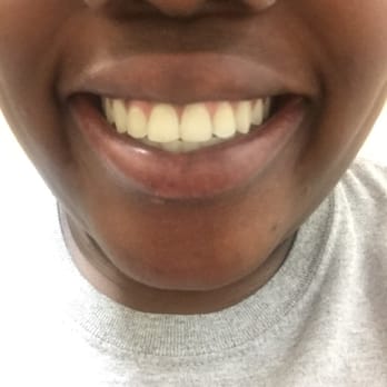 Diamond Braces - Orthodontists Near Me - Hackensack, New Jersey