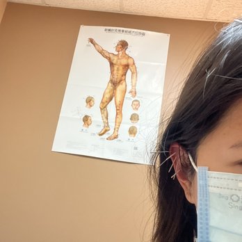 Eastvale Acupuncture & Herbs - Acupuncture needles in my ear - Traditional Chinese Medicine Near Me - Corona, California Eastvale Acupuncture & Herbs - Acupuncture needles in my ear - Traditional Chinese Medicine Near Me - Corona, California