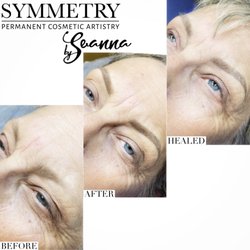 Before, immediate after, 7 weeks healed