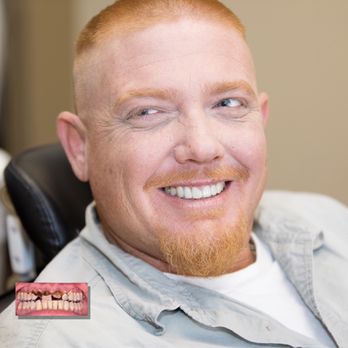 The Smile Centre - Venice - Restorative Dentistry, before and after. - General Dentistry Near Me - Venice, Florida The Smile Centre - Venice - Restorative Dentistry, before and after. - General Dentistry Near Me - Venice, Florida