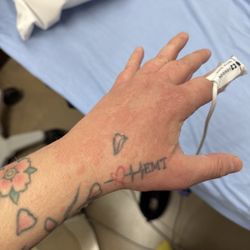ER at S Las Vegas Blvd - Rash