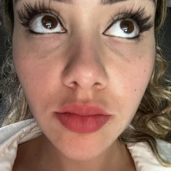 Aère Aesthetics Los Angeles - Me after under eye filler - Permanent Makeup Near Me - Beverly Hills, California