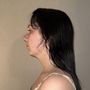 Photo of Zannis Plastic Surgery