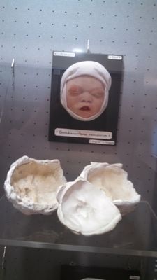 Moulagen museum by null