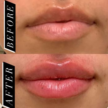 Filter Me Beauty Bar - Skin Care Near Me - Princeton, Texas Filter Me Beauty Bar - Skin Care Near Me - Princeton, Texas